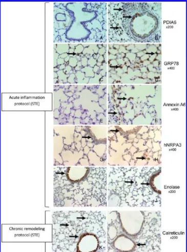 Figure 4. Validation of identi ﬁ ed protein candidates by immunohisto- immunohisto-chemistry