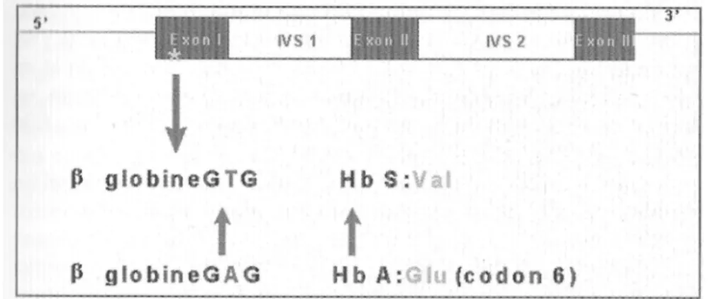 Figure 1 : schéma du gène globine et de la mutation βS. 