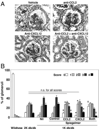 Figure 3. Renal pathological features in 6-month-old db/db mice. A: