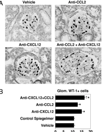 Figure 6. Renal mRNA expression in 1K db/db mice. RNA isolates from kidneys of 1K db/db mice underwent quantitative real-time PCR for several genes, as indicated