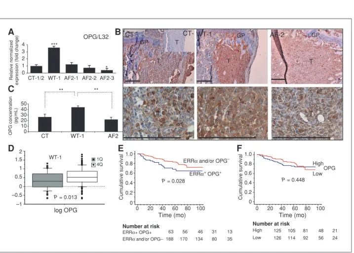 Figure 5. Correlation of ERRa and OPG in BO2 cells and breast cancer patients. A, real-time PCR carried out on RNA extracted from BO2 clones showed increased expression of OPG by ERR a (ANOVA, P &lt; 0.0001)