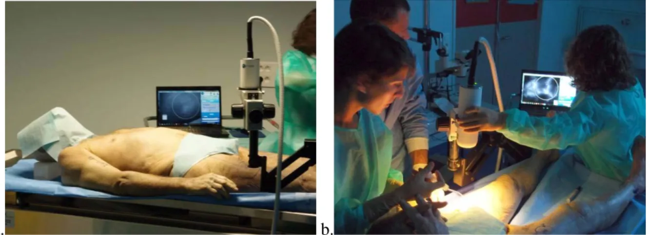 Figure  2:  a.  cadaver  in  the  supine  position  with  the  Fluobeam  fixed  over  the  thigh,  b