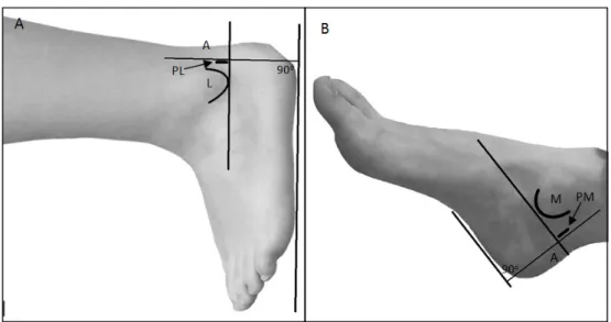 figure 3  (A) The ankle is kept in a neutral position for making the anatomic landmarks that are needed for portal placement