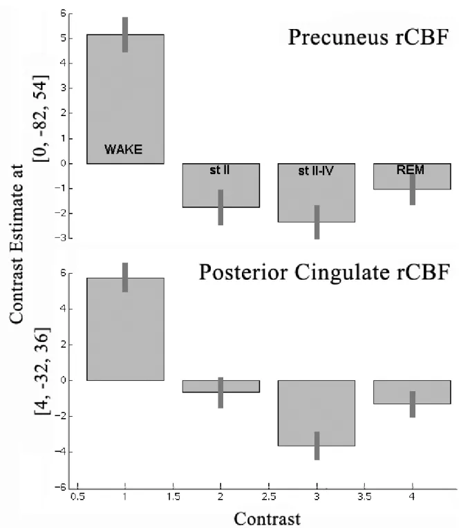 Figure 3. Estimates of rCBF in precuneal and posterior cingulate cortices during wakefulness and three stages  of sleep