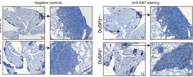 Fig 8. Increased LLC tumour mass in DUSP3 -/- mice lungs is associated with increased in situ proliferation of these cells