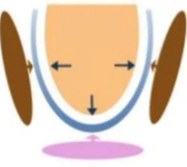 Figure 2 : Schéma explicatif du couloir dentaire de Château avec en bleu le couloir dentaire de  Château, en marron le muscle buccinateur, en rose l’orbiculaire et en beige la langue 