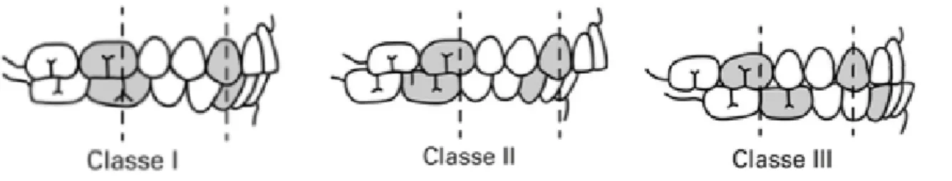 Figure 7 : Représentation schématique de la classe d’Angle 