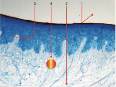 Figure 5 : Interaction du laser avec les tissus :  