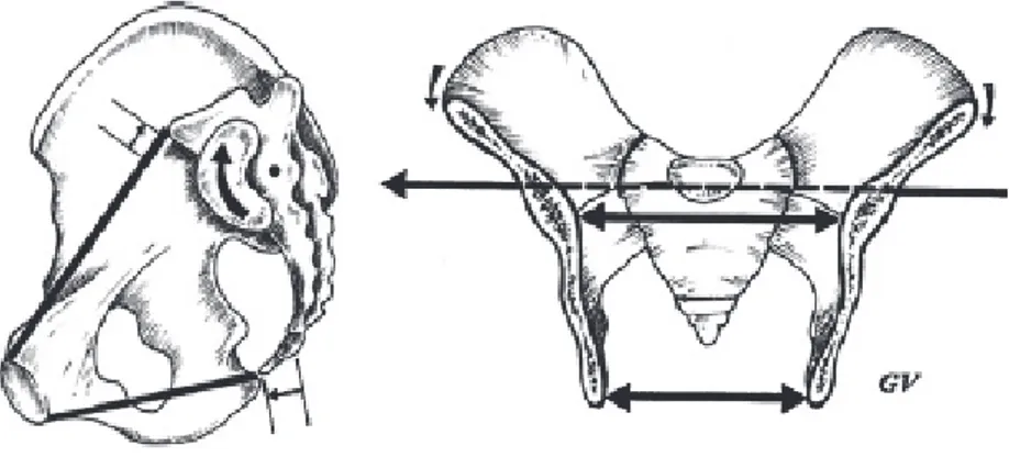 Figure 11 : Contre-nutation (d’après Versier (13)). 