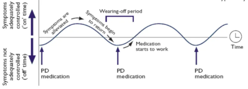 Figure 3: Périodes « on » et « off » du traitement médicamenteux chez le parkinsonien 