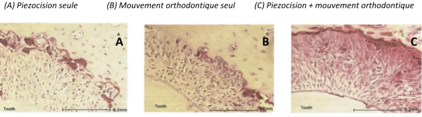 Figure 1 : Coupes histologiques d’os de rats montrant l’activité ostéoclasique à J+1 