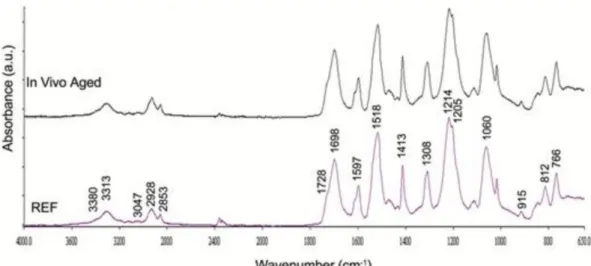 Figure 5 : Composition chimique obtenue par spectrophotométrie d’un aligneur Invisalign® de  référence et d’un aligneur après 15 jours de port