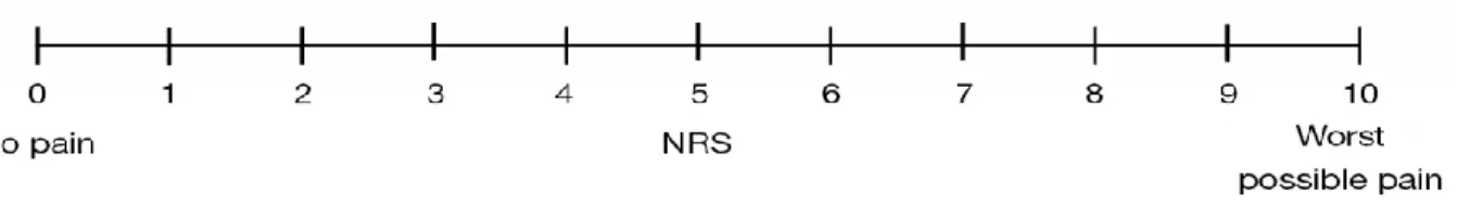 Figure 7 : représentation de l’échelle Numerical Rating Scale 
