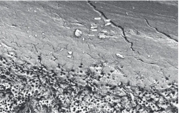 Fig 6 : Surface Dentinaire Canalaire. La partie inférieure propre et les Tubulis apparents,  la partie supérieure recouverte d'une couche de Smear Layer et de quelques débris 