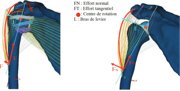 Figure 22 : Comparaison des positions et orientations des efforts dans le cas de l’épaule saine et  et avec une prothèse inversée, d’après Astier  1
