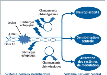 Figure 4 : illustration  schématique des principaux  mécanismes périphériques  et centraux à l’origine des  douleurs des neuropathies  périphériques  