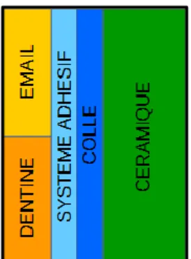 Figure 10 : Les quatre composants de l'assemblage dento-prothétique d’une céramique
