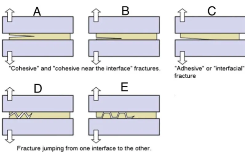 Figure 2 : Principaux types de fractures 