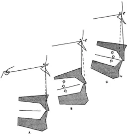 Figure 13: Variation de l'angle ANB selon l'angulation du plan d'occlusion