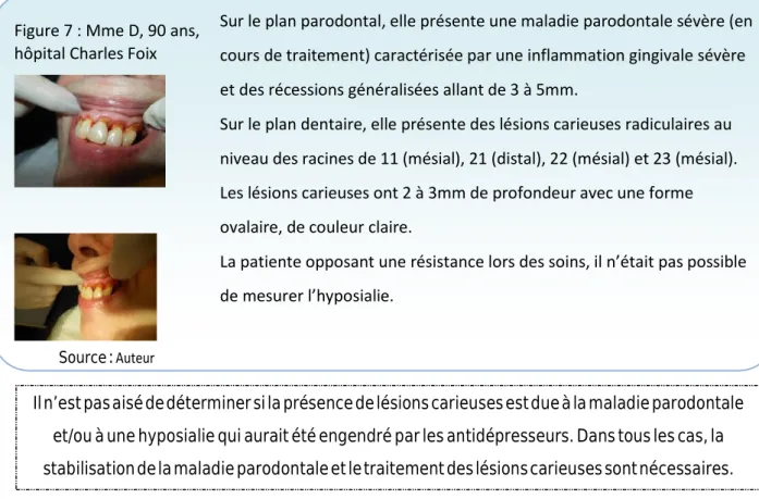 Figure 7 : Mme D, 90 ans,  hôpital Charles Foix 