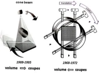 Figure 6 : Principes d'acquisition du volume anatomique numérisé du Cone Beam (acquisition directe  du volume et détermination secondaires des coupes) et scanner RX (acquisition première des coupes 