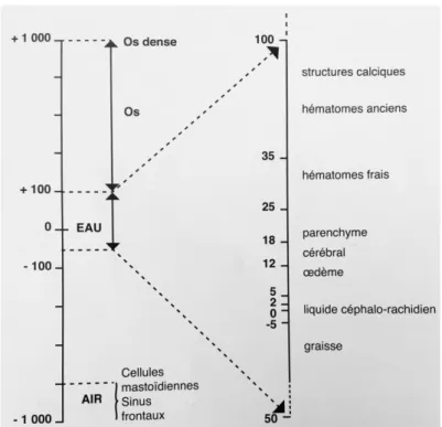 Figure 8 : Echelle des densités de Hounsfield 