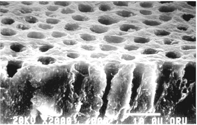 Figure 2 : Architecture dentinaire en MEB 