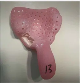 Fig 4: Photo d'un porte empreinte individuel, perforé en regard des implants.  