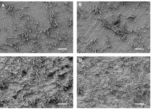 Figure 6 : Images acquises par microscopie électronique à balayage de la formation de biofilm par le  complexe de bactéries parodontopathogènes après 72 h d’incubation  
