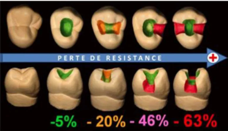 Figure 1 : Perte de résistance en fonction de la perte de substance dentaire 