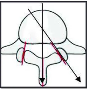 Figure 8 : Angle facettaire transverse 