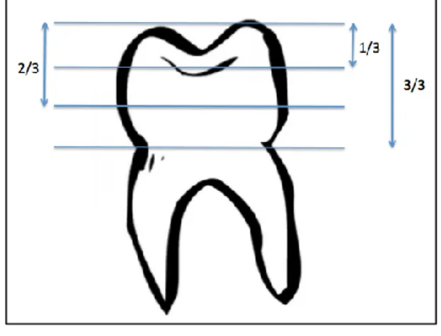 Figure 5: Evaluation de la plaque dentaire 