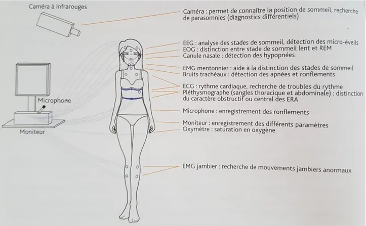 Figure 13 : Les capteurs de la polysomnographie