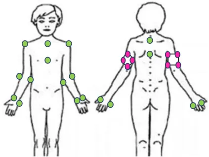 Figure 6 : schéma de la position des marqueurs sur le corps d’un enfant vue de face et dos  (en vert : marqueurs selon les normes ISB ; en rose : marqueurs pour repérage 