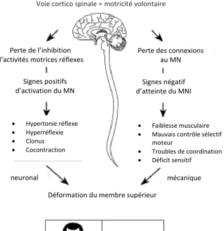 Figure 2 : Physiopathologie de l’atteinte du membre supérieur chez les enfants atteints de  PCu