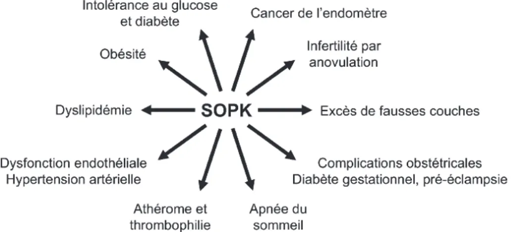 Figure 7 : Ensemble des complications associées au SOPK. (D’après Fernandez et al. — Traité EMC