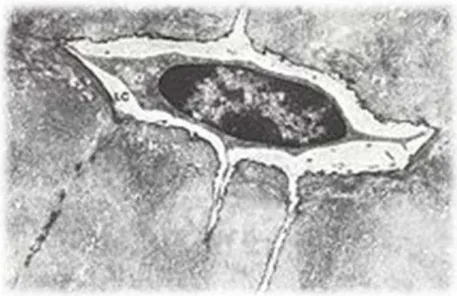 Figure 9 : Un ostéocyte et ses prolongements cytoplasmiques, logés dans un ostéoplaste
