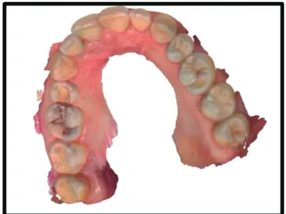 Figure 10 : Empreinte optique d’une arcade maxillaire 