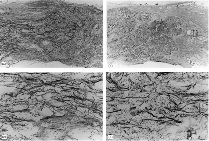 Fig. 9. Immunostaining using NF antibody shows the neuritic invasion in both the resected area and the polymer  implant (a) as compared to an adjacent section immunostained without the primary antibody (b)