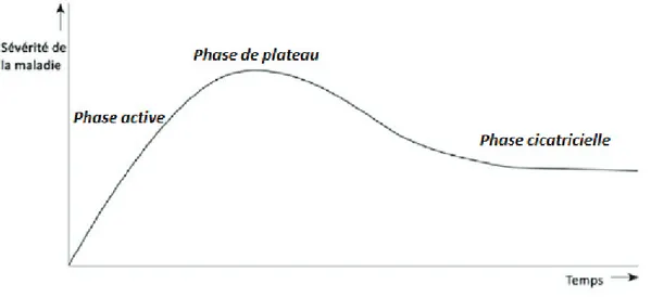 Figure 4 : Courbe de Rundle représentant l’évolution naturelle  habituelle de l’orbitopathie