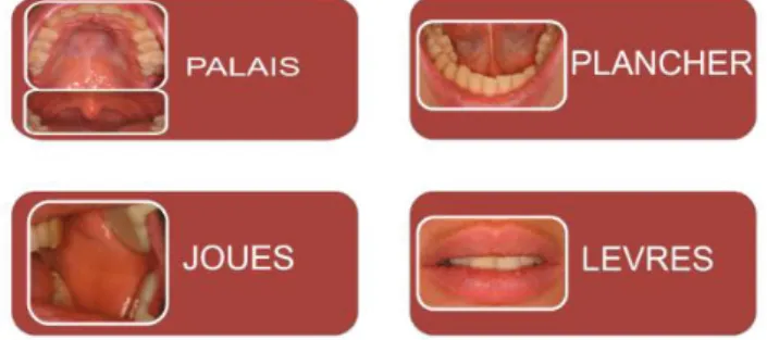 Figure 5. Capture d’écran de la page « Anatomie et histologie de la muqueuse buccale »