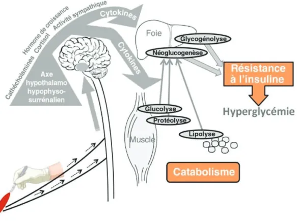 Figure 1 : Schéma simplifié des mécanismes d'agression chirurgicale avec la cascade de réactions  neuro-hormonales par le biais de l'axe hypothalamo-hypophysaire, aboutissant à une libération de  cytokines source de dysfonctionnement de plusieurs organes