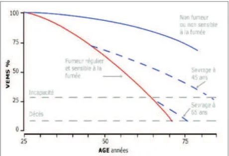 Figure 4 : Evolution de la capacité respiratoire (VEMS) à l’arrêt du tabac en fonction de l’âge d’après Fletcher  et al.1977 