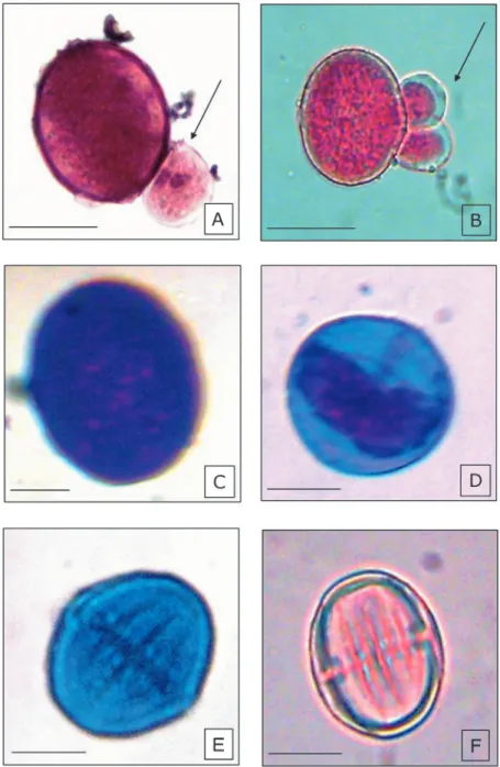 FIGURE 1. Pollen grains stained with 2%