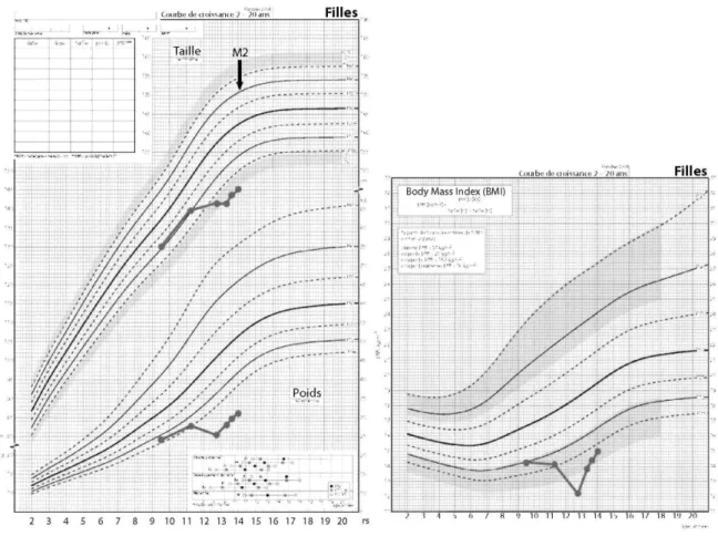 Fig. 2. Changes in height, weight and BMI in a premenarcheal adolescent girl developing AN at 10 years of age