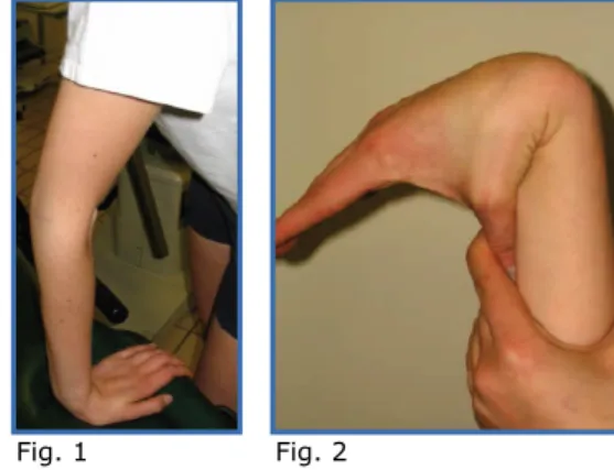 Fig. 1 Fig. 2