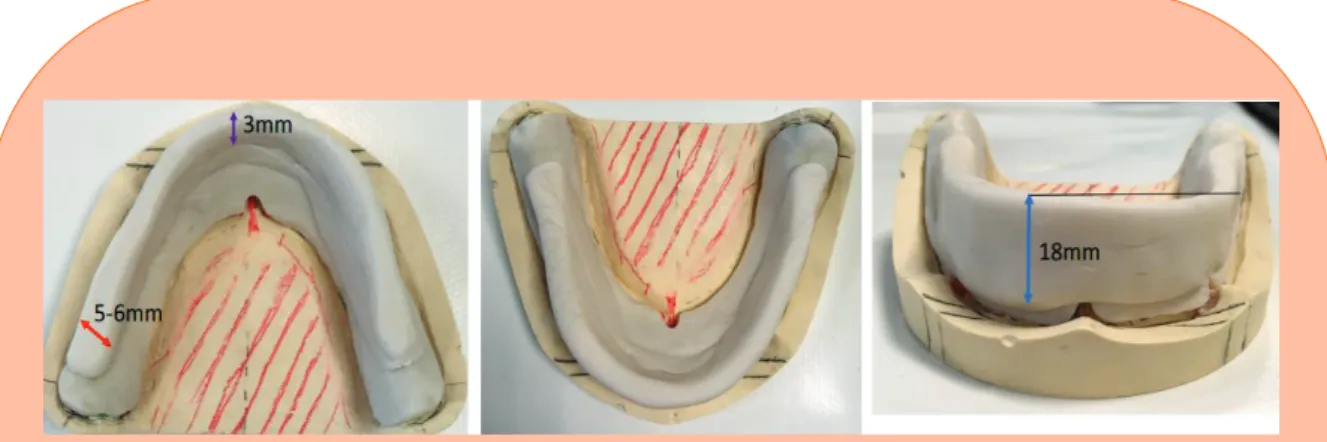 Figure 15 : PEI avec bourrelets de préhension non conformes – Book PAC 