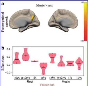 FIG. 2. (a) Mean network connectivity in patients during the music compared with the rest condition for the FPN.