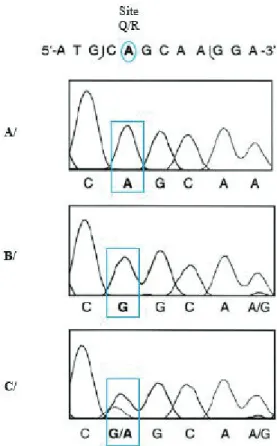 Figure 8: Edition du pré-ARNm de la sous-unité B du récepteur au glutamate dans le système  nerveux central sain et dans les glioblastomes (modifié d’après Maas, Patt et al