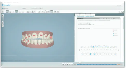 Figure 1: ClinCheck® +%#2'0=#&#34;3*',&amp;#!)&amp;&#34;\3,.2'#,2#,20'2#+#,29*\,'4#01'2=&#34;# 